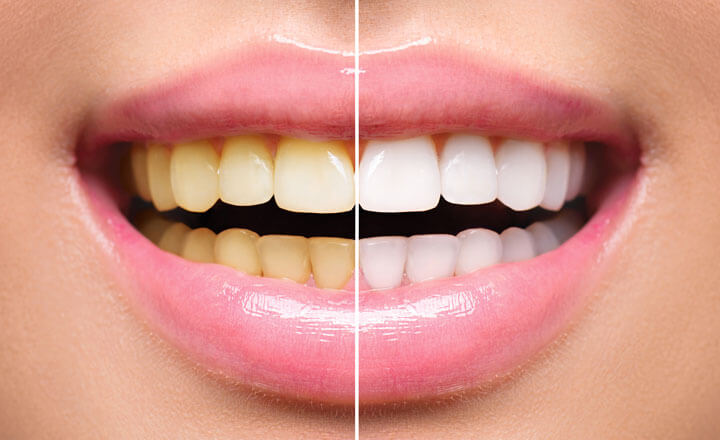 Estetica dentale